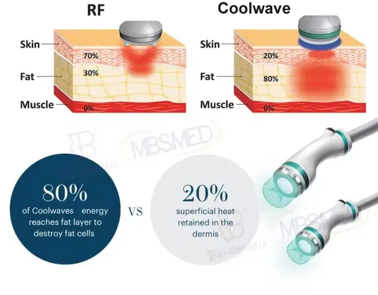 Body Contouring Inbody Cold and Hot Slimming Cellulite Onda Coolwaves Device
