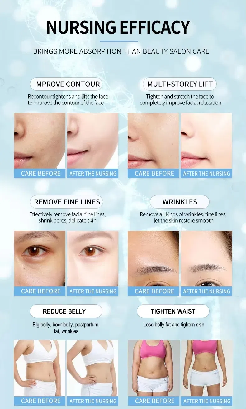 360° Multi-Dimensional Handle 22D Max Hifu Device for Face Lifting and Body Contouring