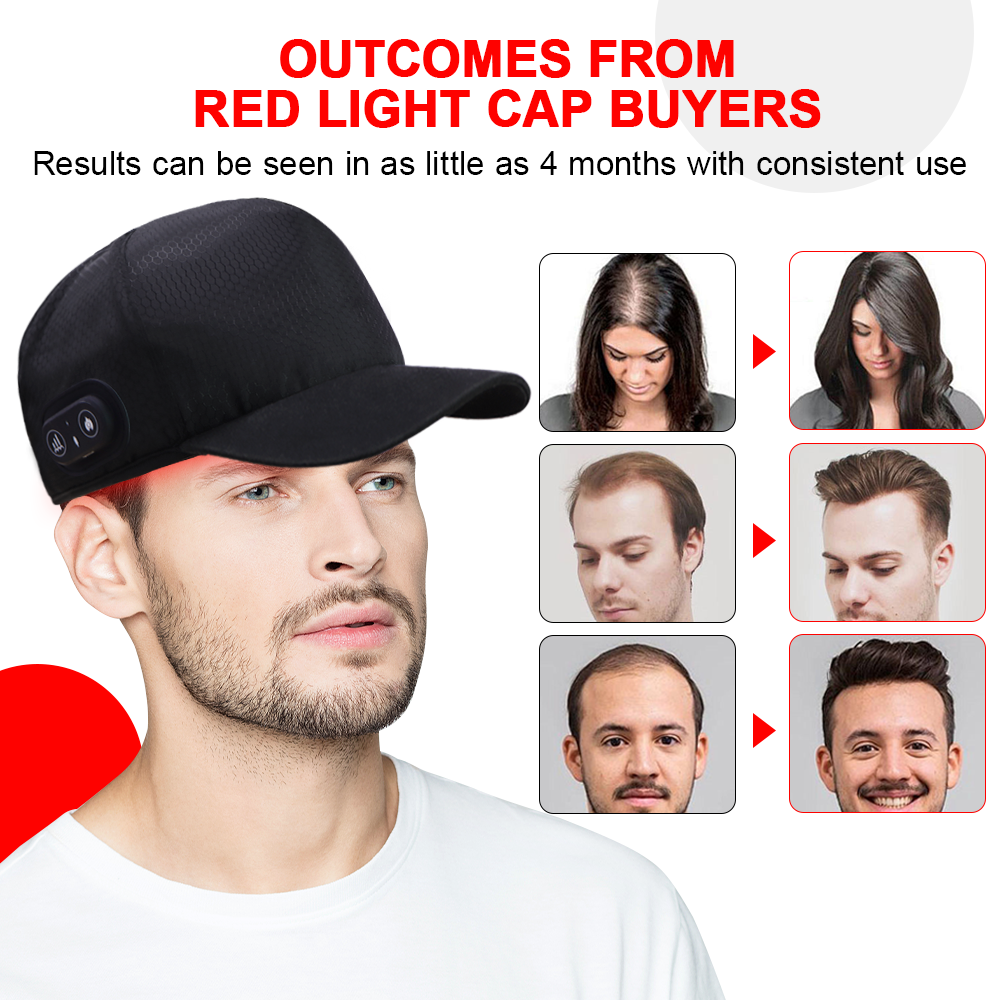 810nm 650nm Wireless Led Scalp Infrared Light Cap Red Light Hat Infrared Helmet Hat Nir Led Red Light Therapy Treatment Cap