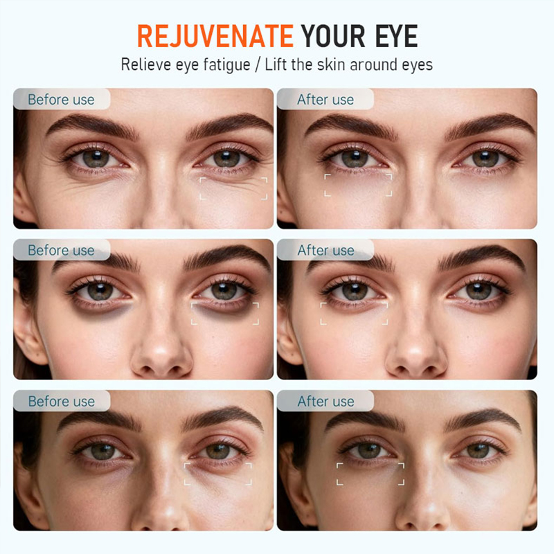 Silicone LED Indicated Red Light Therapy Eye and Face LED Eye Beauty Device Red Light Therapy for Eyes