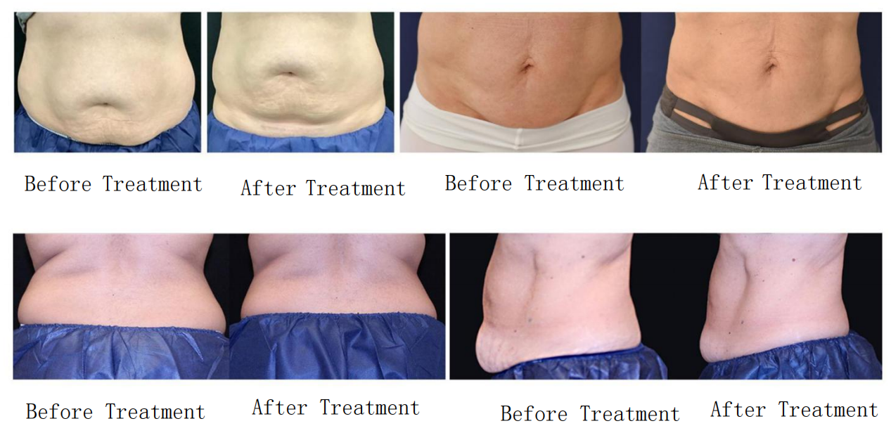 Before and After Results 2