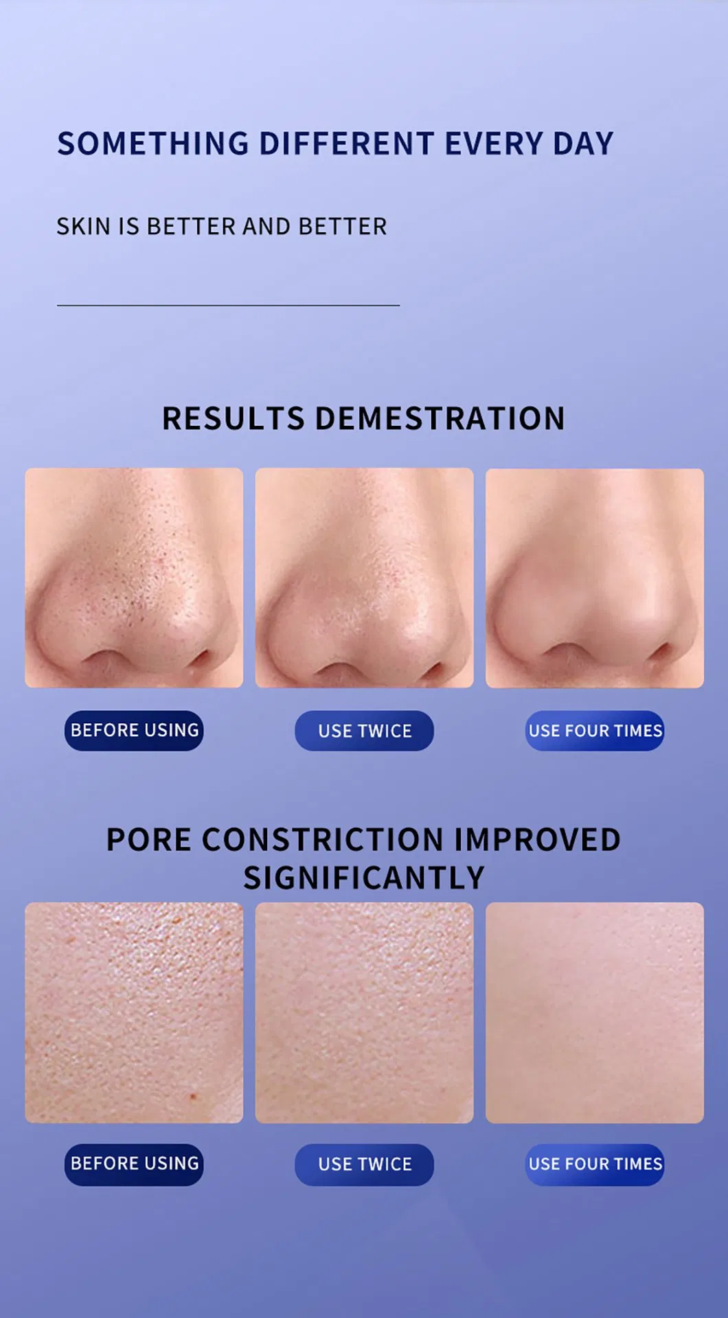 Professional Ultrasonic Skin Scrubber Detail 4
