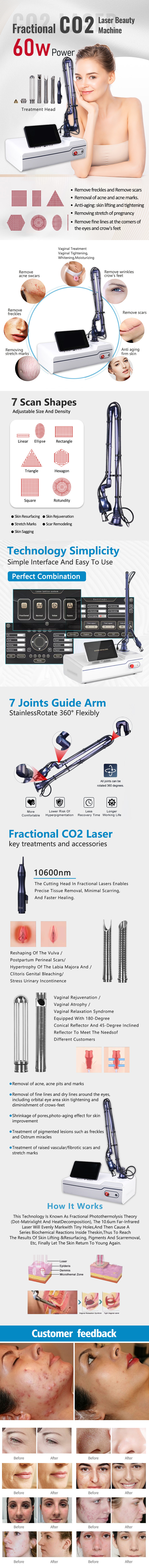 Vaginal tightening device radio frequency rf-tube-10600nm-fractional-co2-laser