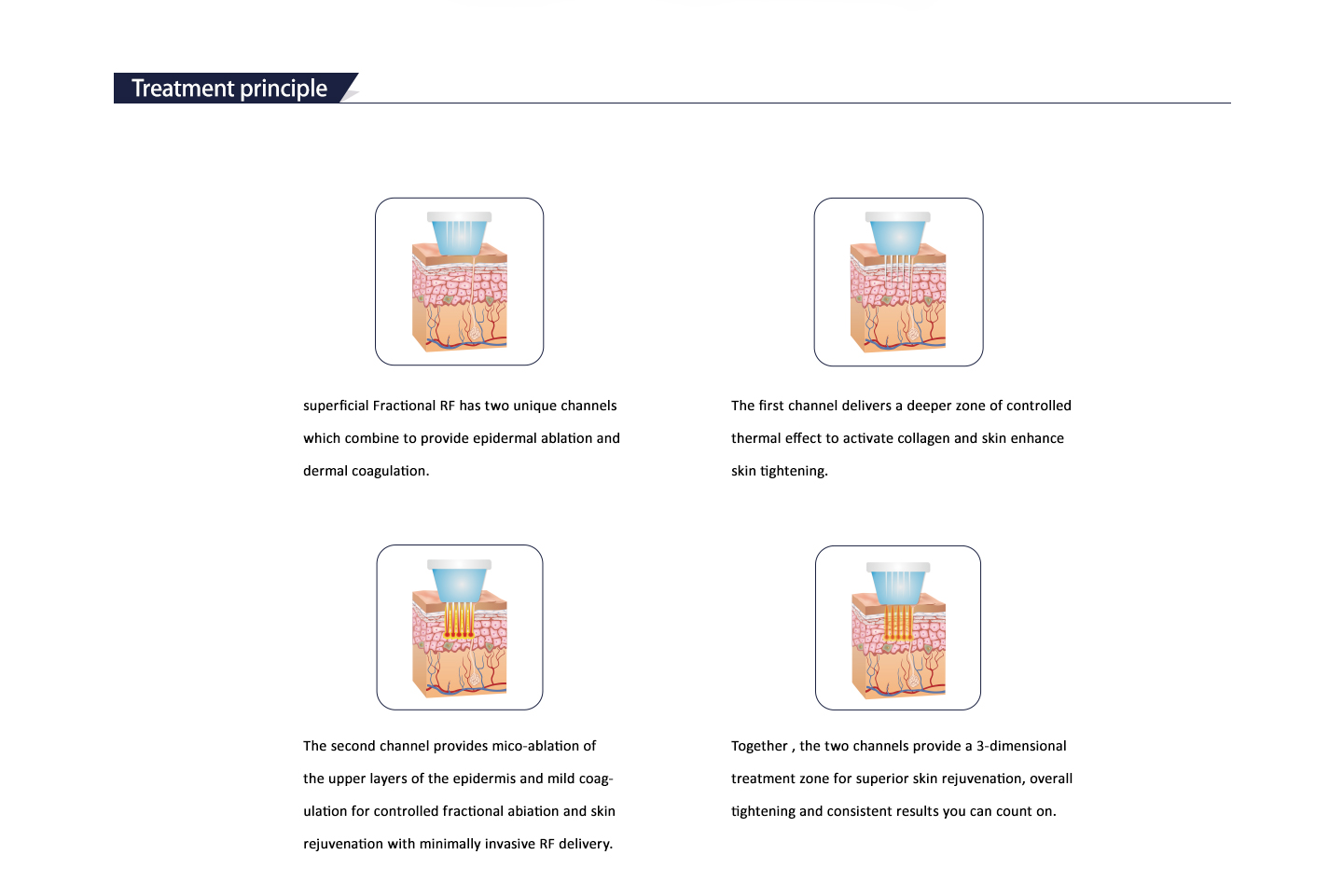 RF Treatment Cartridge Details