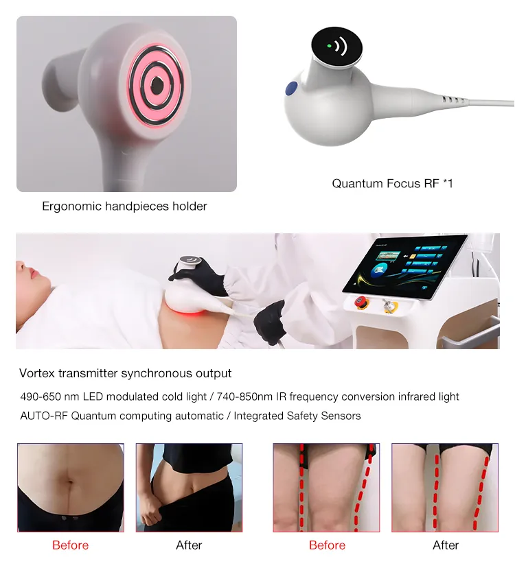 Advanced RF Skin Tightening Device Interface Mode