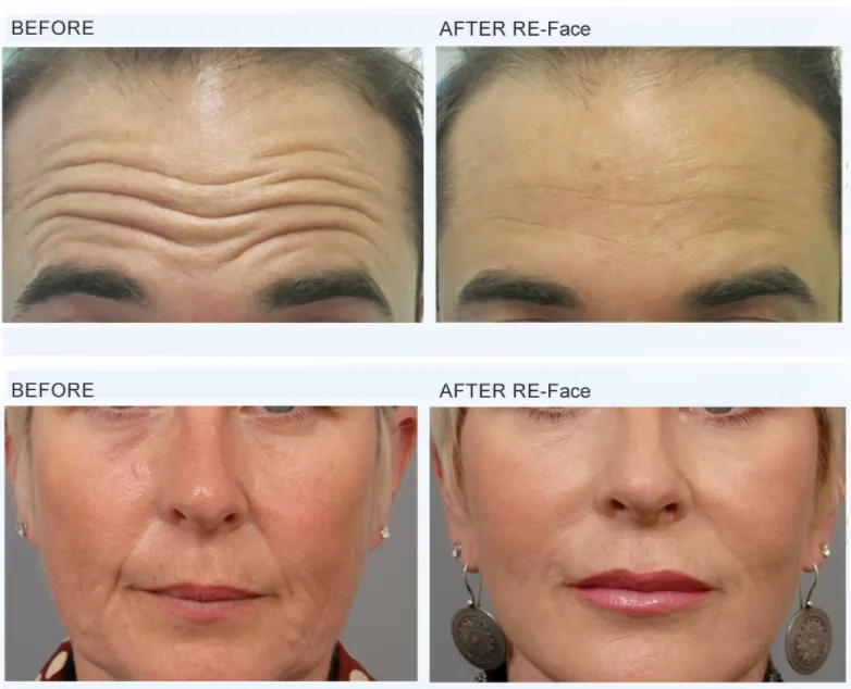 Advanced Skin Magnetic Facial Device Magnetic Beauty Machine for Lifting, Firming, and Anti-Aging Treatment