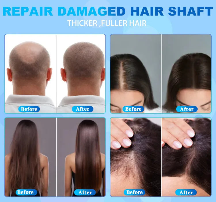 Hair Regrowth Results