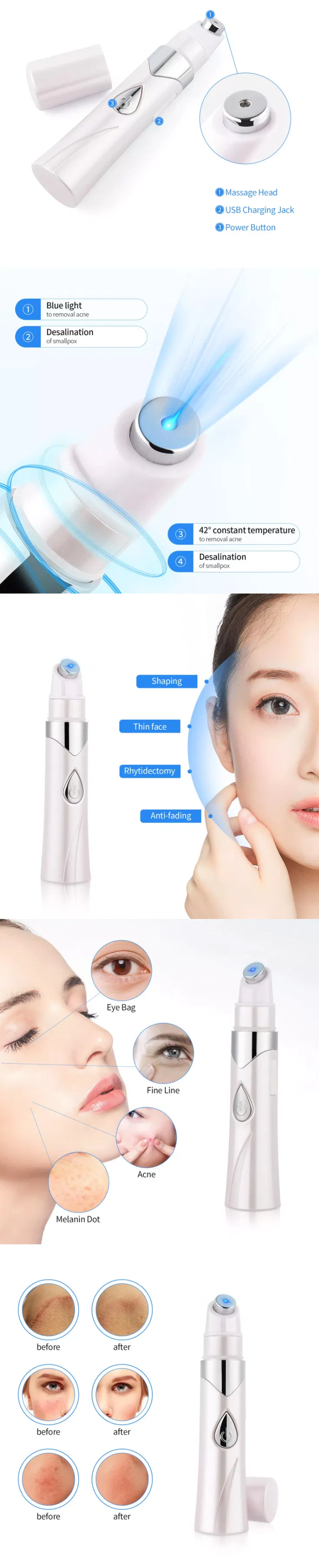 Portable Wrinkle Removal Acne Laser Anti Acne Treatment Removal Pen Beauty Device