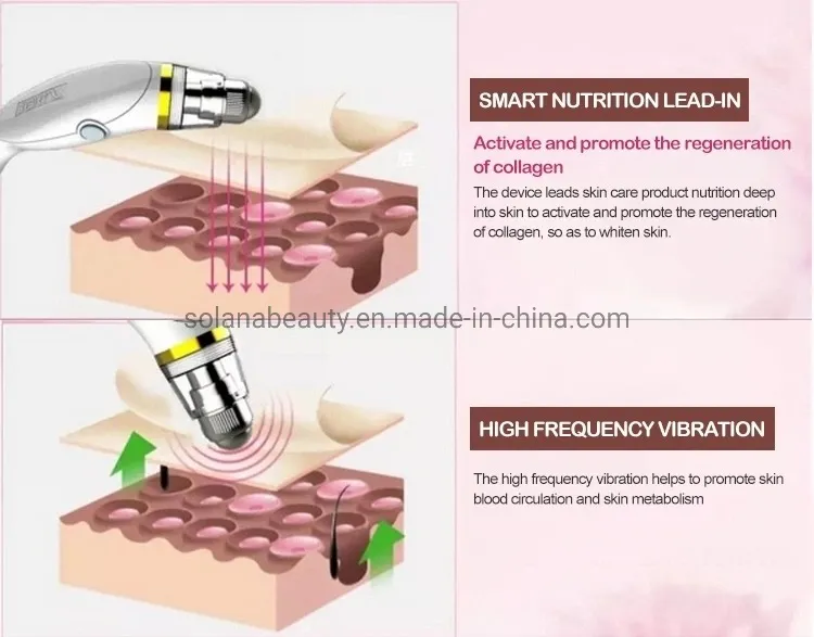 4 Working Mechanisms