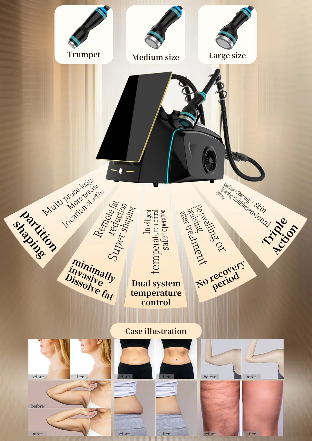 High Performance Cold Wave Slimming Device for Fat Burning and Professional Body Contouring