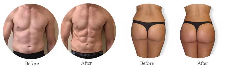 Body Shaping Muscle Building Beauty Machine