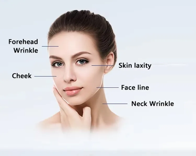360° Multi-Dimensional Handle 22D Max Hifu Device for Face Lifting and Body Contouring