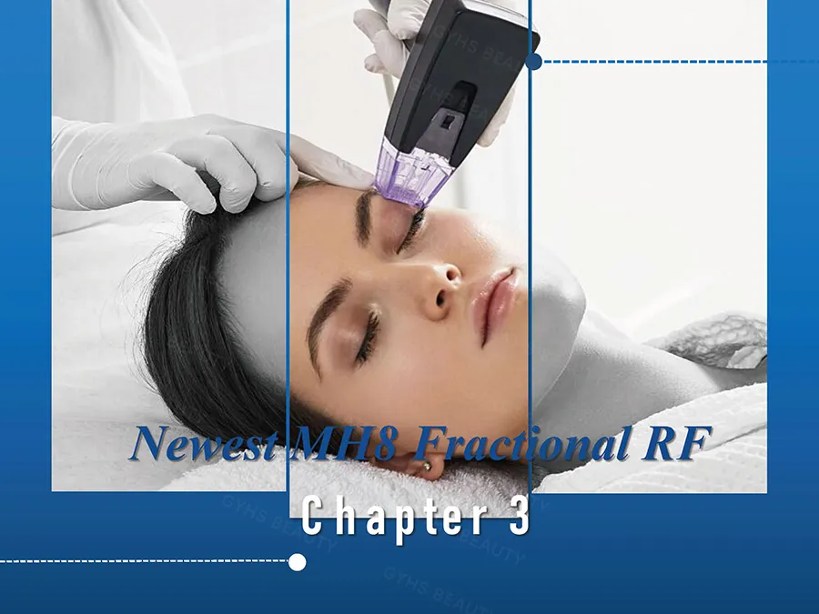 Portable Hifu Device for Skin Tightening & Body Contouring Treatments