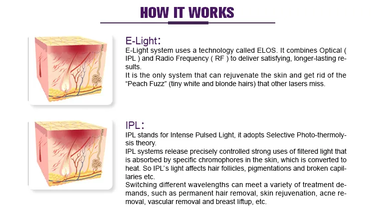 Professional E Light Skin Rejuvenation Machine High Quality IPL Depilator Hair Removal Device
