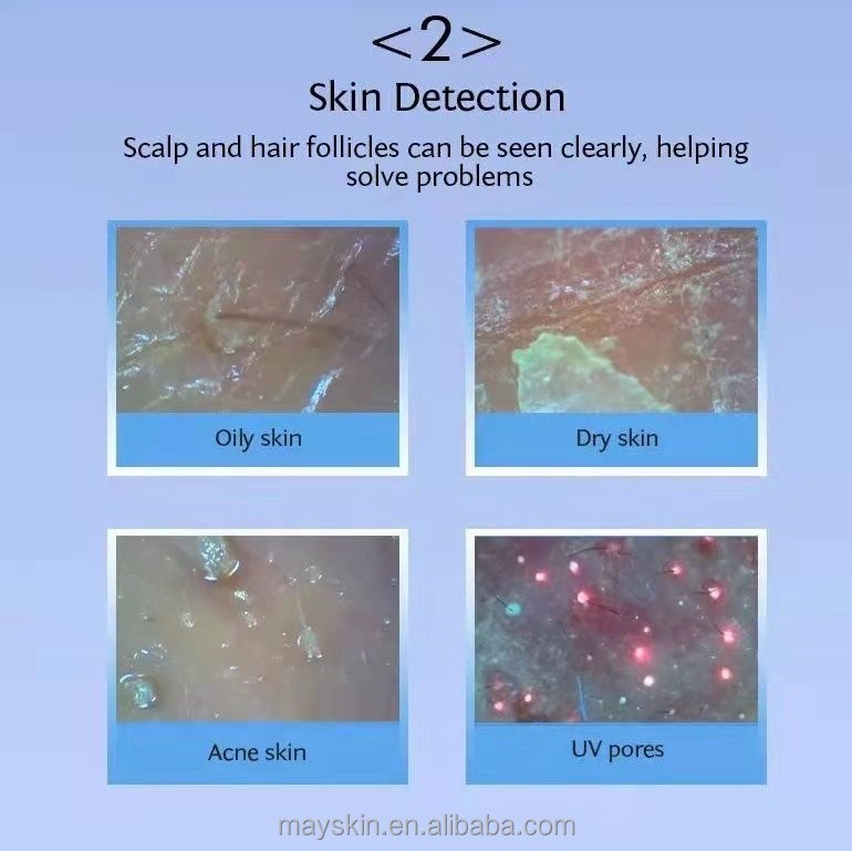 Scalp Analysis Demonstration 2