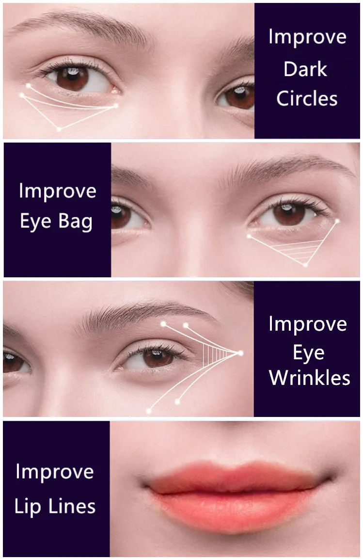 EMS Microcurrent Winkle Removal Red Light Therapy Eye Beauty Device