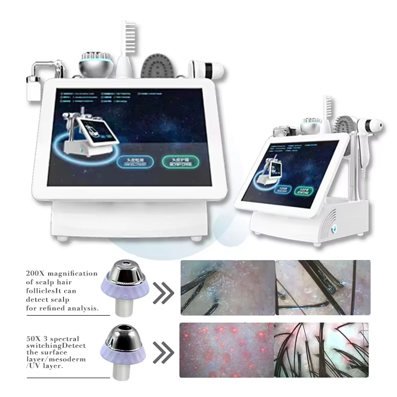 Professional Desktop Hair Follicles Scalp Scanner Hair Analyzer Detail 2