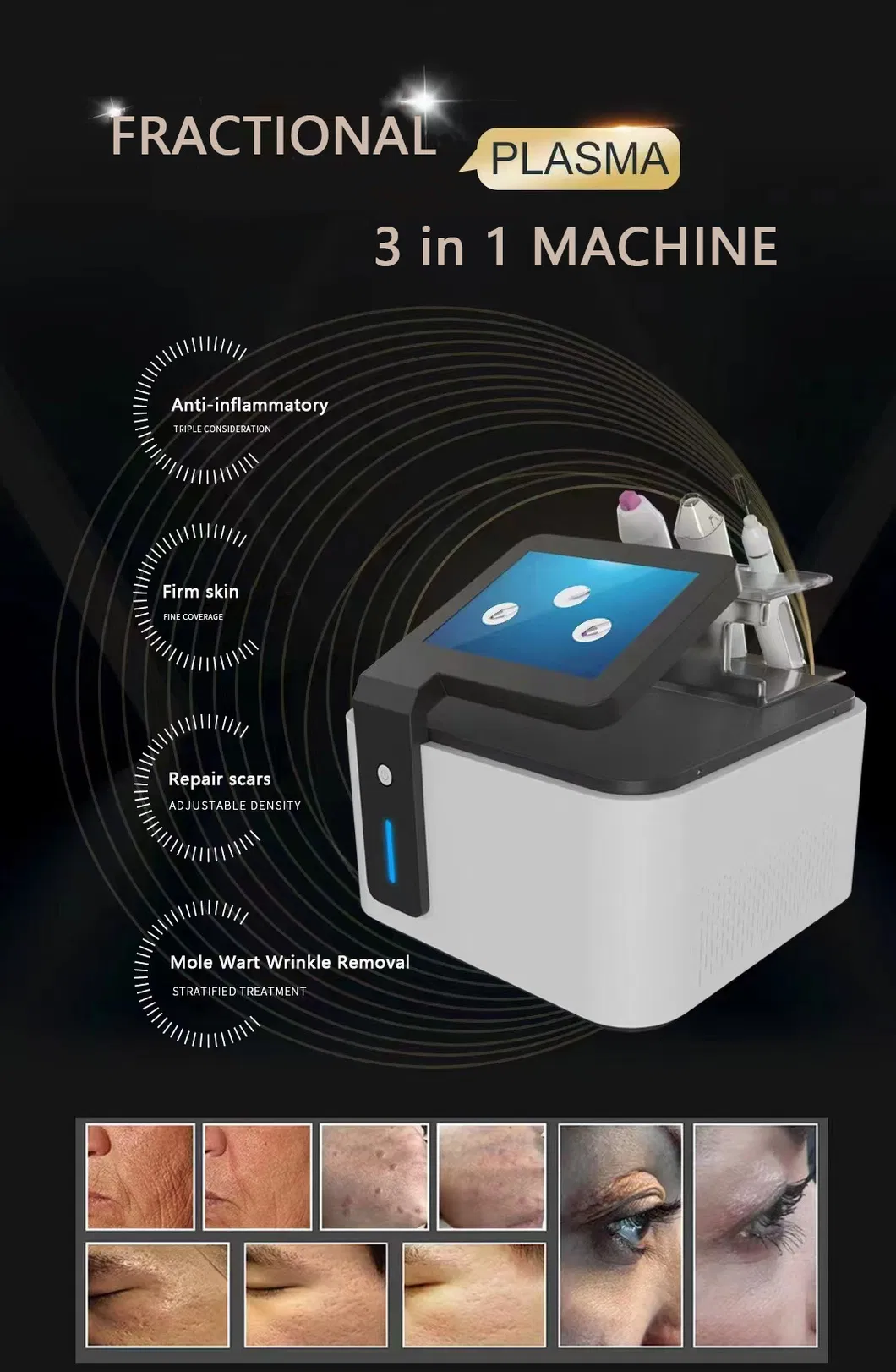 Professional Fractional Cold Jet Plasma Pen Device Details