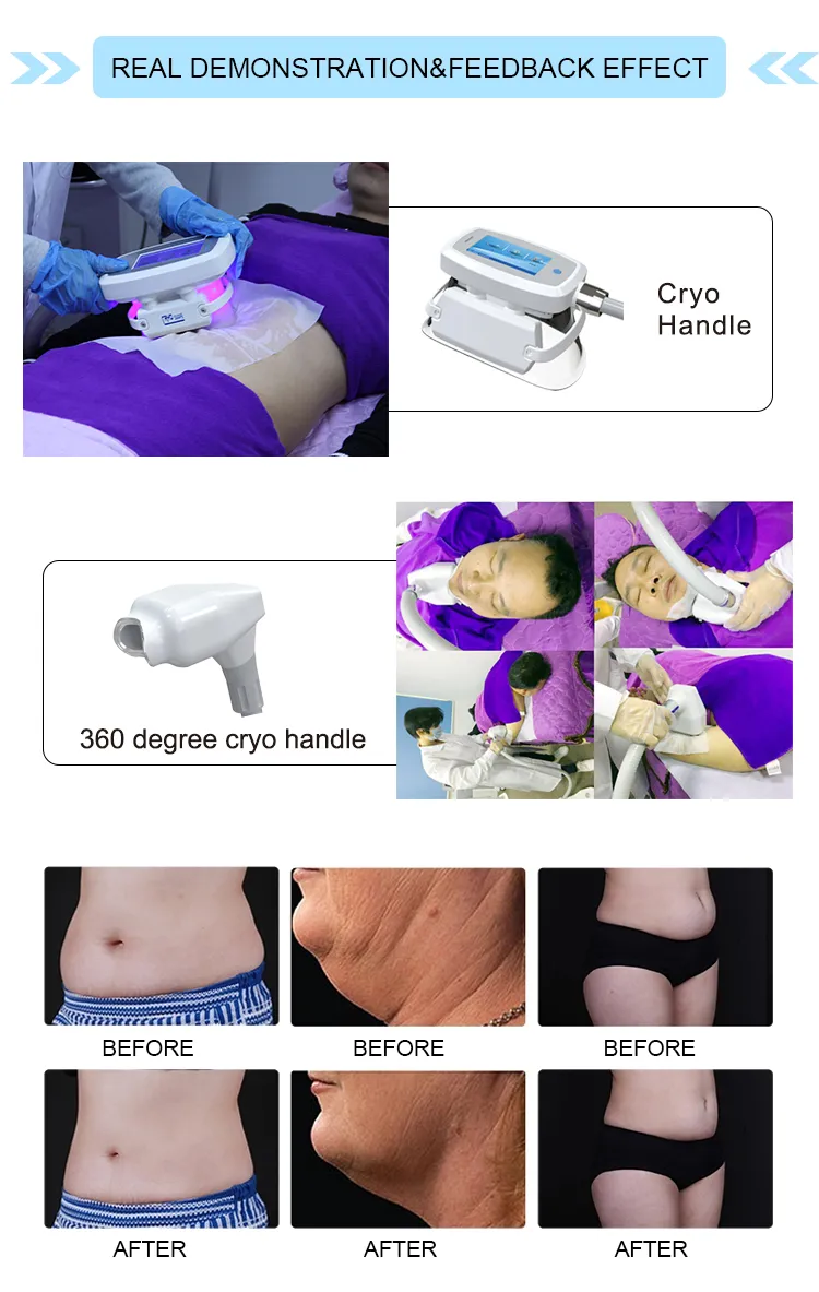 Before and After Results