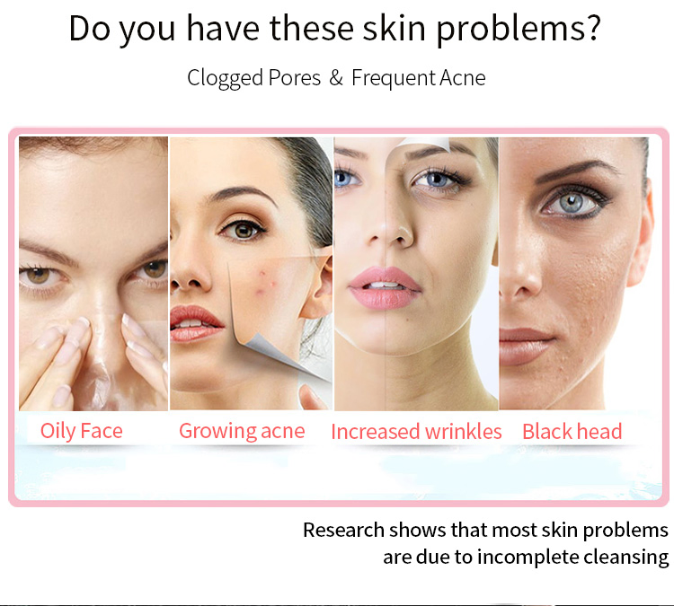 EMS Microcurrent Facial Pore Cleaning Beauty Device
