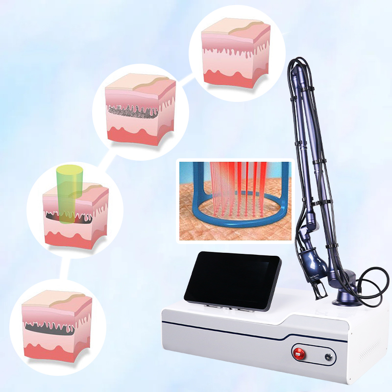 Hot Selling vaginal tightening device radio frequency rf-tube-10600nm-fractional-co2-laser