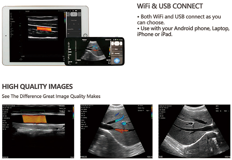 Ultrasound Detail 5