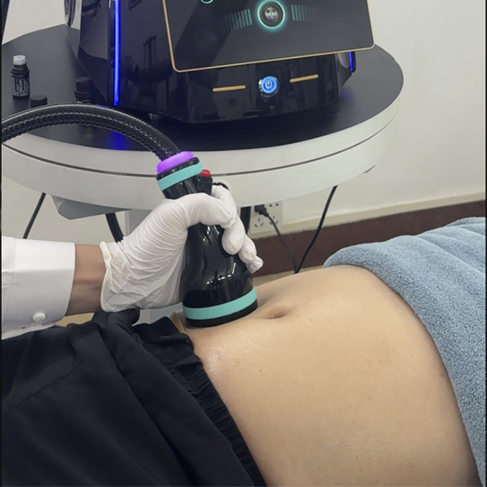 Multi-Functional Onda Pro Delivers Synergistic Energy for Comfortable Slimming and Overall Contour Improvement