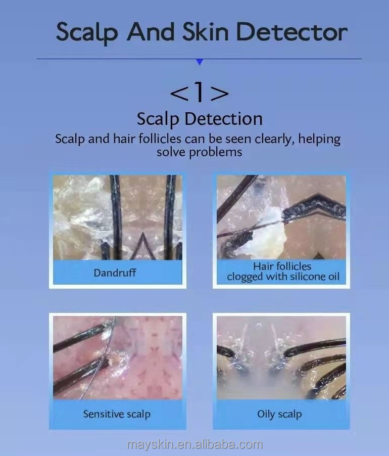 Scalp Analysis Demonstration 1