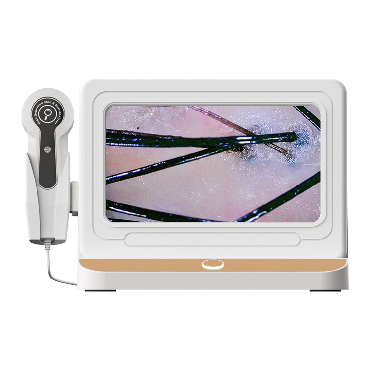 Hair &amp; Scalp Analyzer Scalp Microscope Camera Hair Follicle Detector Skin &amp; Hair Analyzer Hair Loss Analysis