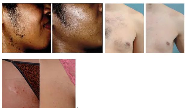 Before & After Comparison 2