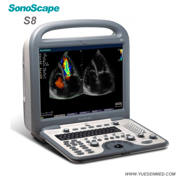 Medical Hospital Sonoscape S8 Portable 4D Color Doppler Ultrasound Machine