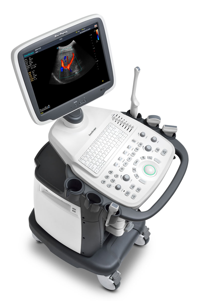 Hospital Medical Full Digital Trolley Color Doppler Ultrasound Machine Sonoscape S12