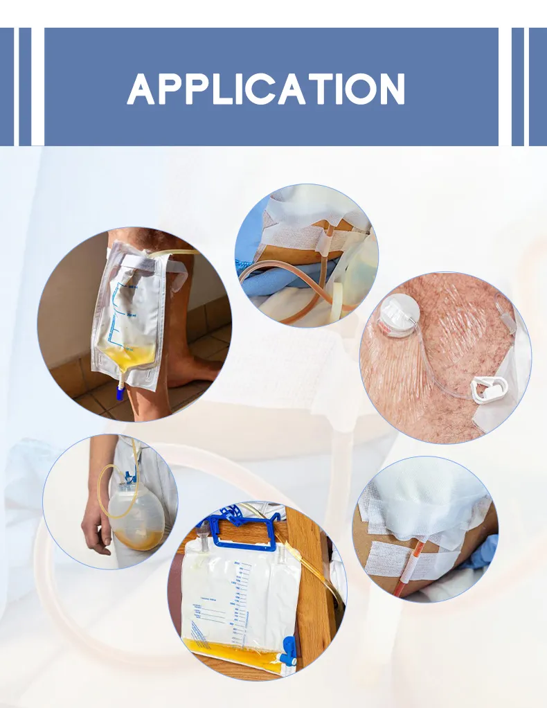 Wound Drainage System 4