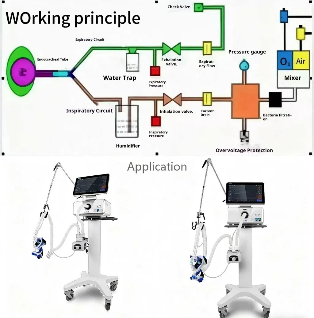 Breathing Circuit Use Case