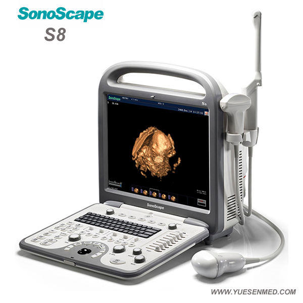 Medical Hospital Sonoscape S8 Portable 4D Color Doppler Ultrasound Machine