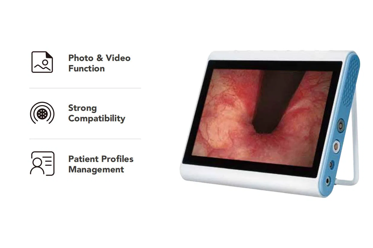Digital Video Ureteroscope Single Use Flexible Ureteroscope