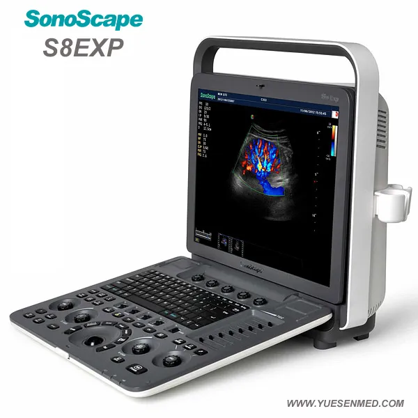 S8exp Portable Ultrasound Machine