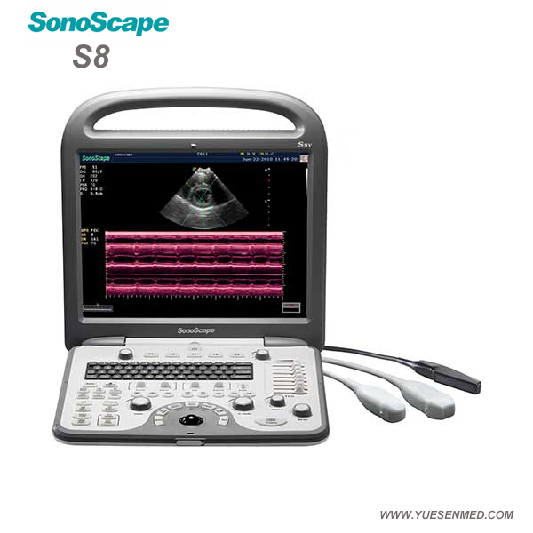Medical Hospital Sonoscape S8 Portable 4D Color Doppler Ultrasound Machine