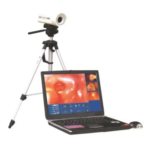 Sony Colposcopy Systems