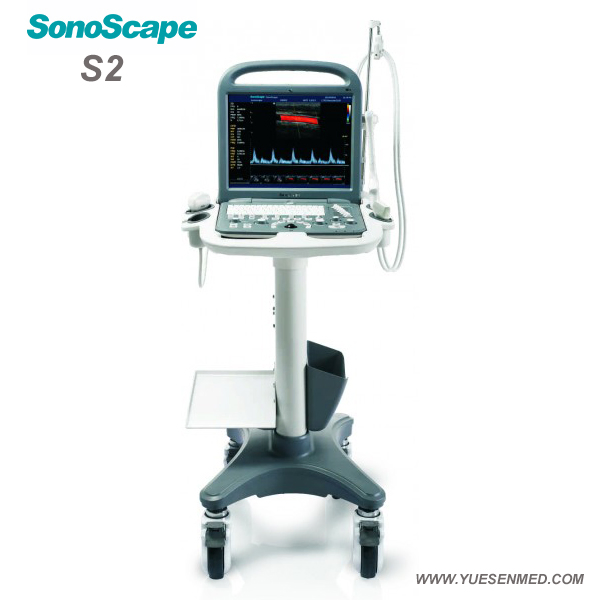 S2 Sonoscape 2D 3D 4D Multi Frequencies Color Doppler Ultrasound Scanner Machine