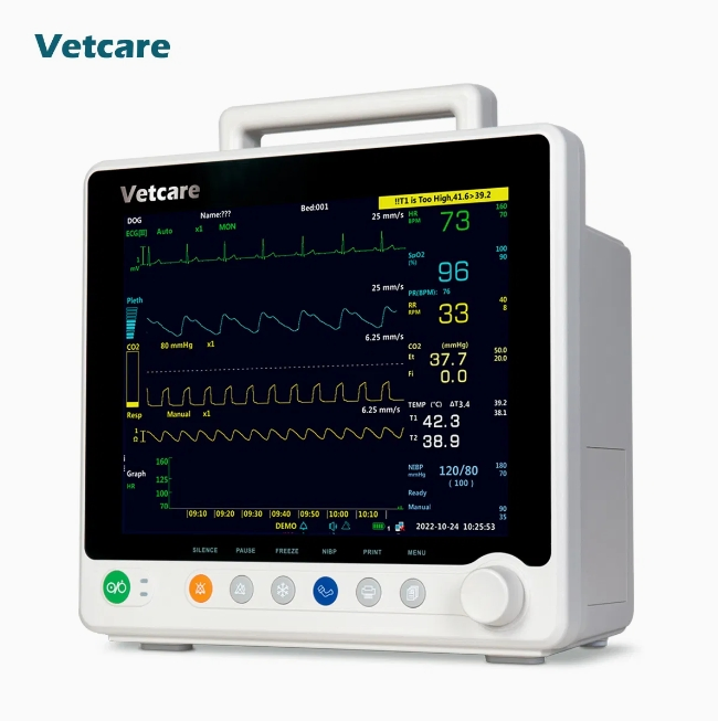 Advanced Cardiac Monitoring System for ECG Results Analysis Portable EKG Machine
