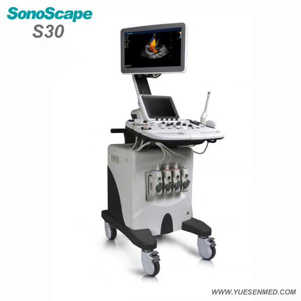 Hospital Medical Sosonoscape S30 3/4D Color Doppler Trolley Mobile Ultrasound Machine