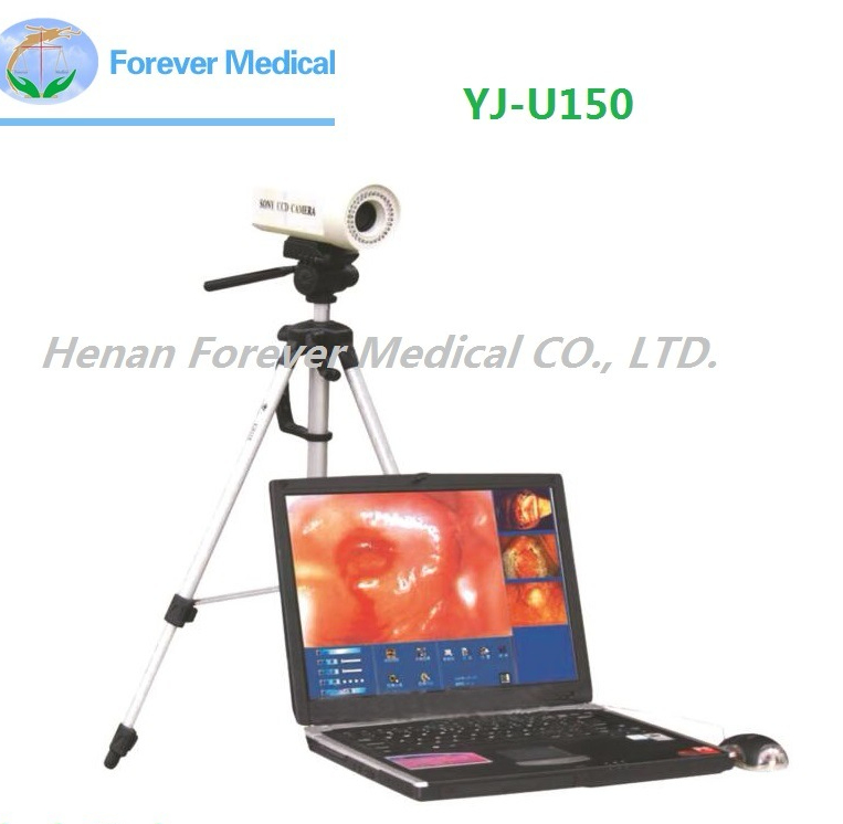 Ce Approved Portable Sony Colposcopy Systems for Gynecological (YJ-U150)
