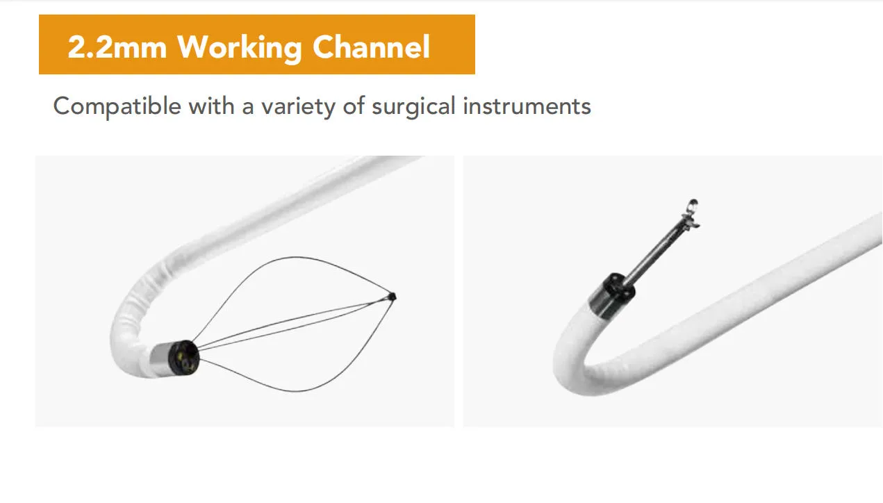 Flexible Ureteroscope View 6