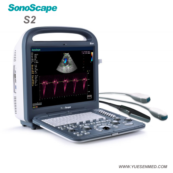 S2 Sonoscape 2D 3D 4D Multi Frequencies Color Doppler Ultrasound Scanner Machine