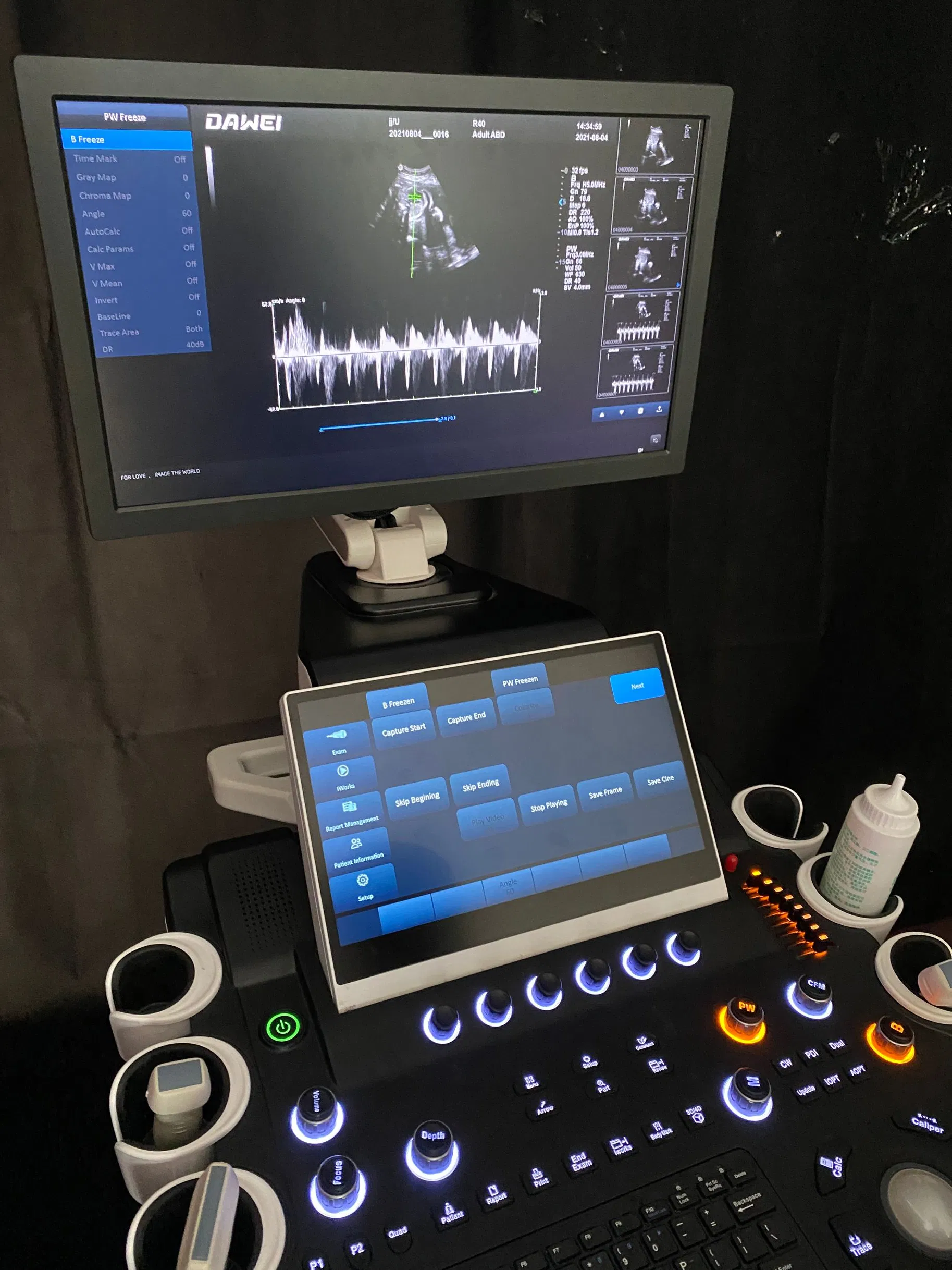 Dw-T50 Dual-Screen Cart-Based Color Doppler Ultrasound Diagnostic System with 4D Imaging