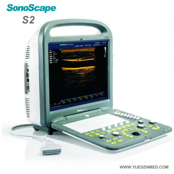 S2 Sonoscape 2D 3D 4D Multi Frequencies Color Doppler Ultrasound Scanner Machine