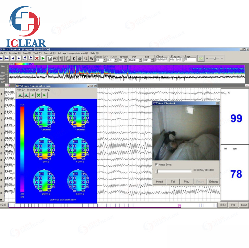 High Quality 32 Channel EEG System Digital Versatile Medical Electroencephalography