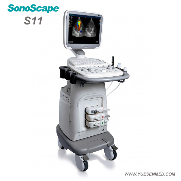 Hospital Medical Mobile Sonoscape S11 Color Doppler Ultrasound Equipment Machine