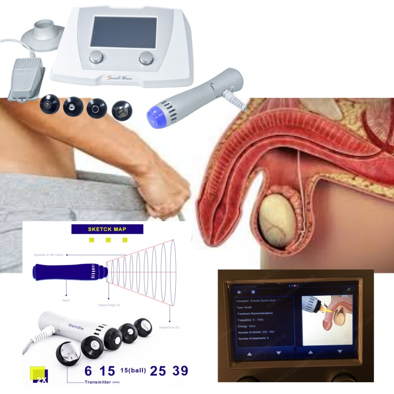 Radial Shockwave Therapy System: Advanced Solution for Female Health Enhancement